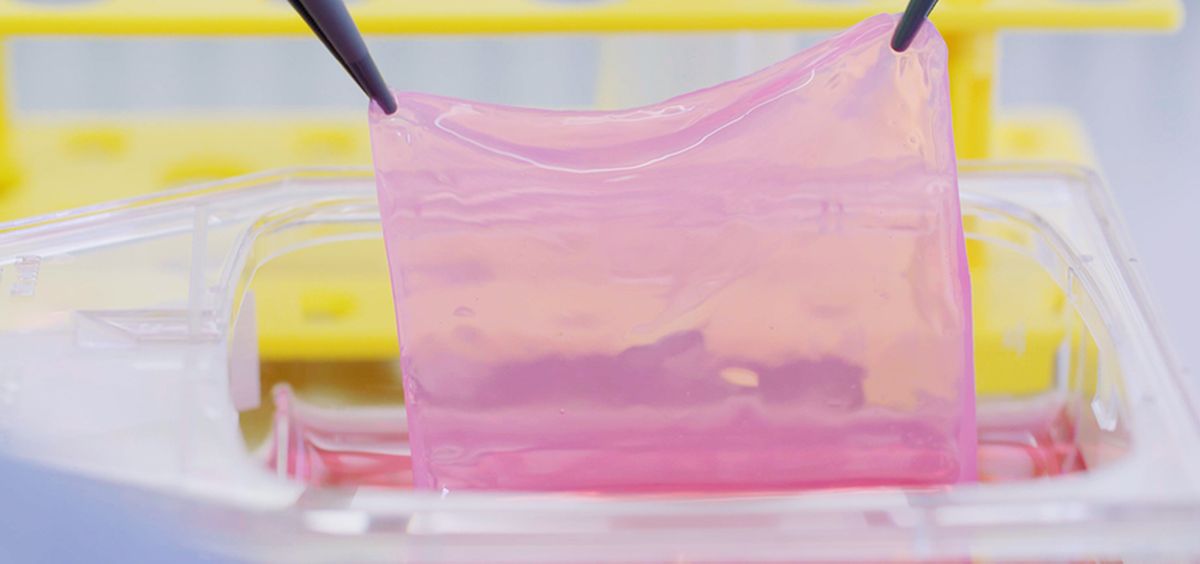 CUTISS’ denovoSkin first large scale transplantation delivers proof of principle