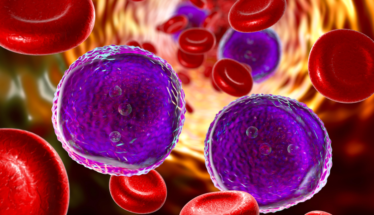 Leukaemia cells Leukaemia cells
