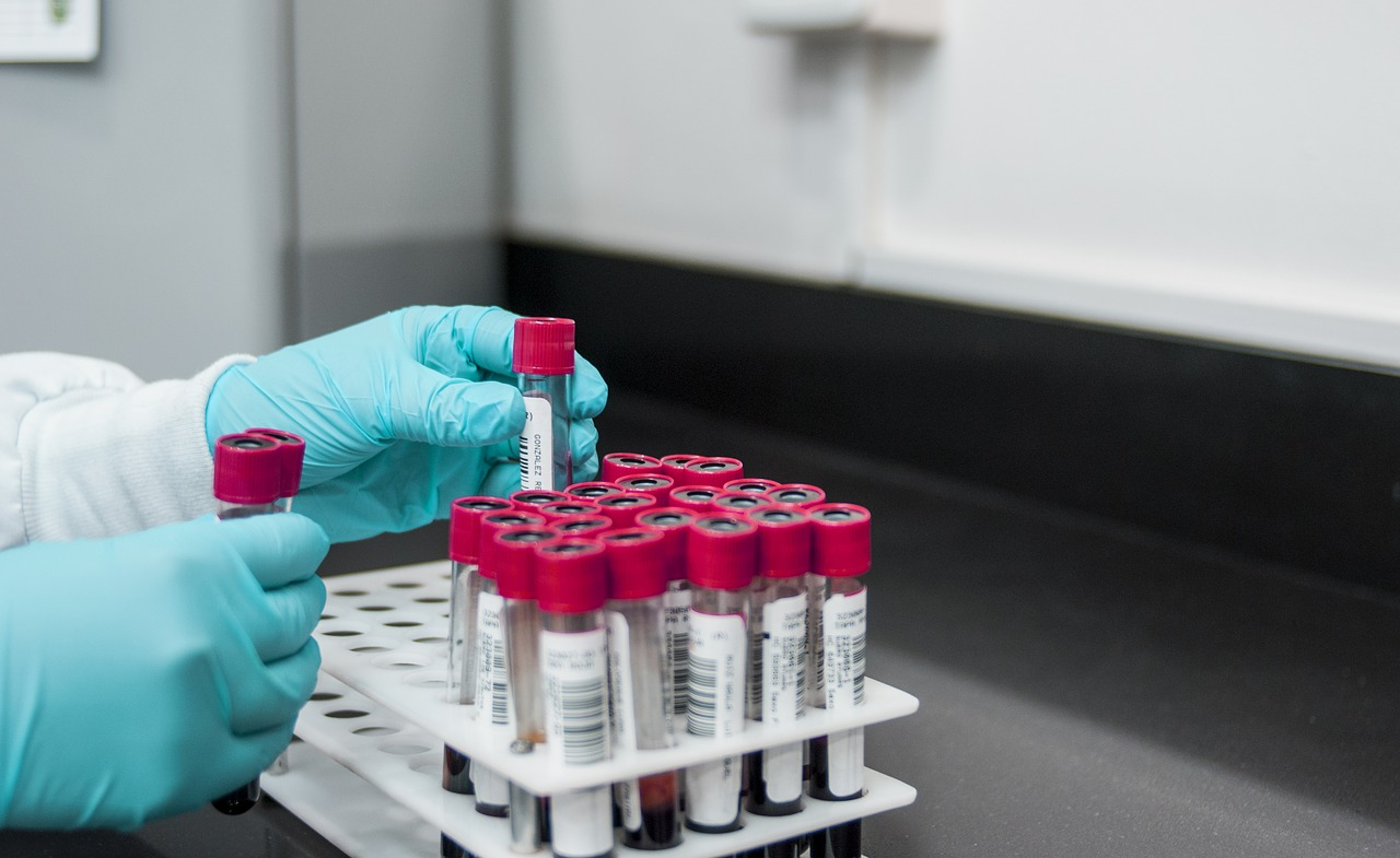 Clinical Trial Clinical Trial